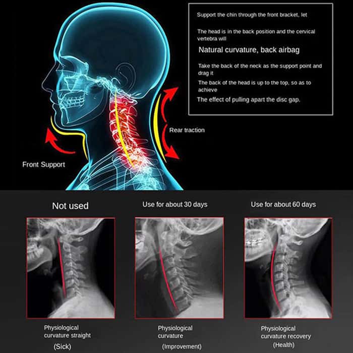 Brace for Neck_Cervial Collar_Aspen Collar_Neck Collar_Efforest Image