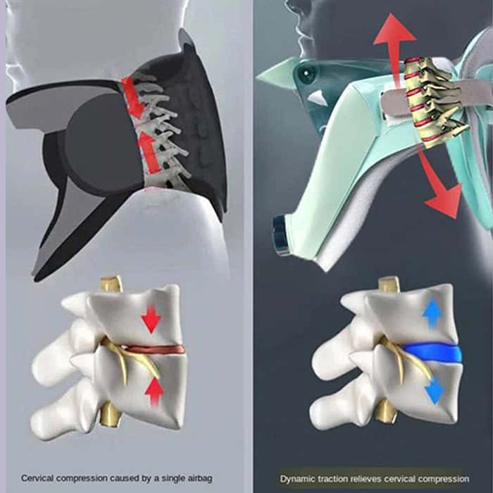Brace for Neck_Cervial Collar_Aspen Collar_Neck Collar_Efforest Image