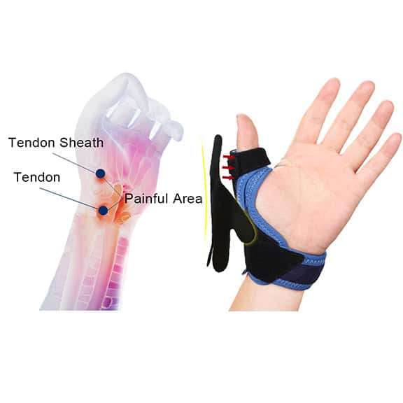 Spica Thumb_Splints For Thumb_Thumb Brace_Efforest Image