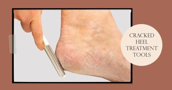 The Ultimate Guide to Cracked Heel Treatment Tools: Say Hello to Happy Feet