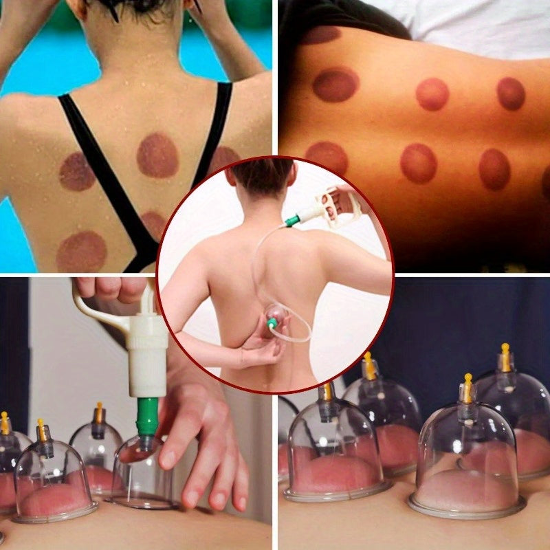 32 Cups Cupping Set Chinese Massage Medical Body Healthy Relax Vacuum Suction