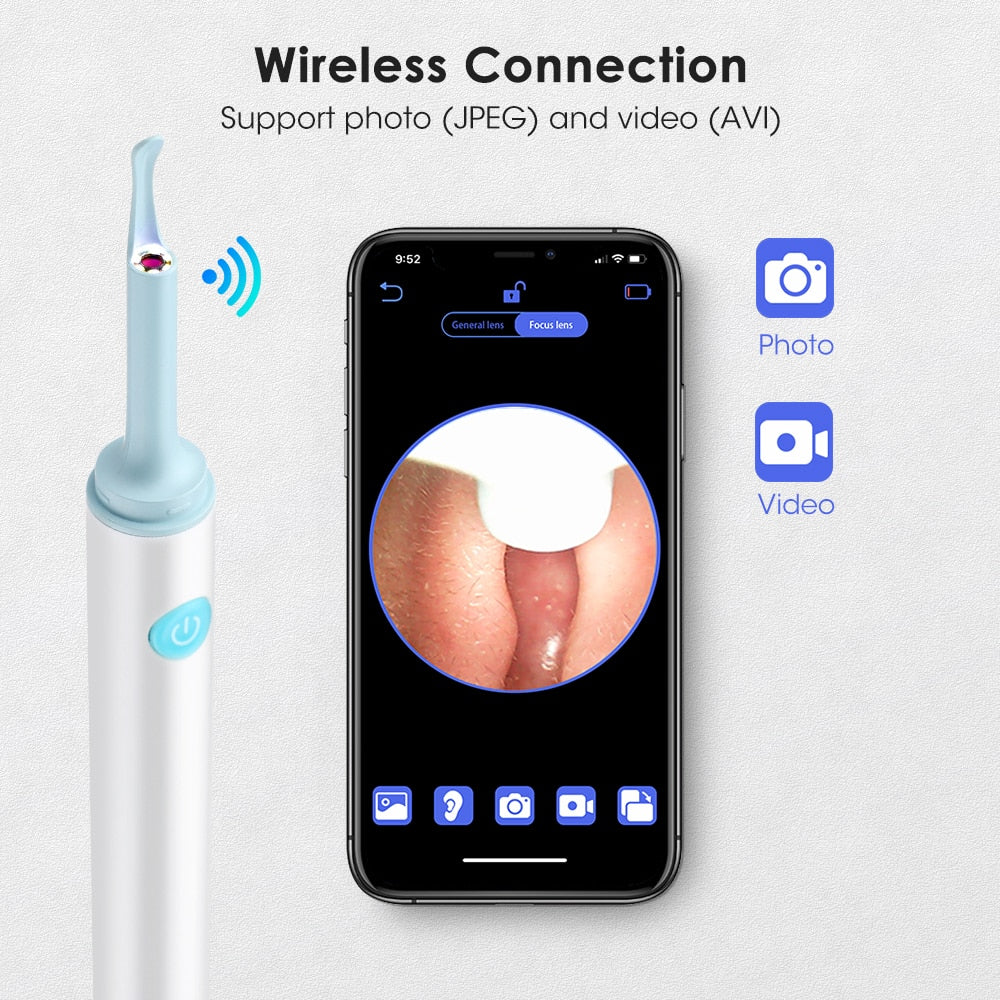 Endoscope Ear Pick Wireless Ear Camera 3.9mm