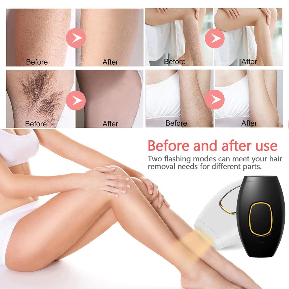 At-Home Laser Hair Removal_Laser Hair Removal Device_Laser Hair Removal Machine_EFFOREST