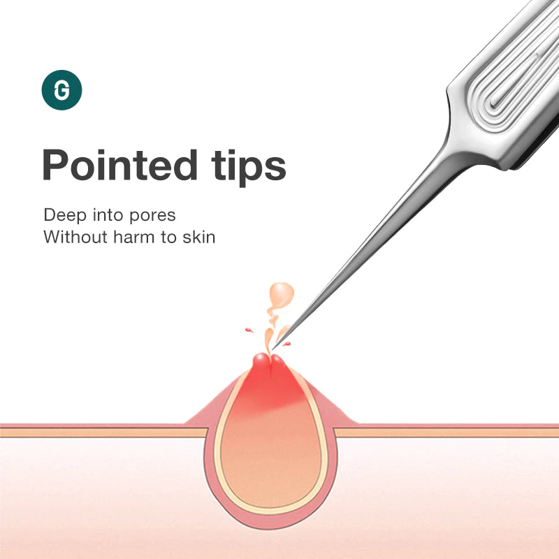 Ingrown Hair Tweezers