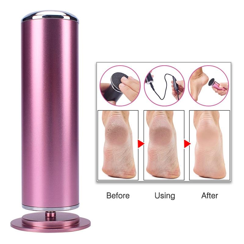 Callus Remover For Feet_Pedicure Tool to Remove Dead Skin From Feet_Efforest